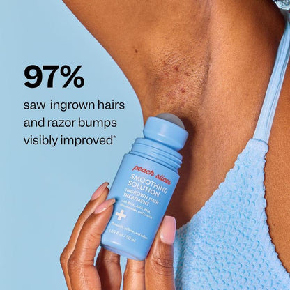 Smooth Away Ingrown Hair Treatment