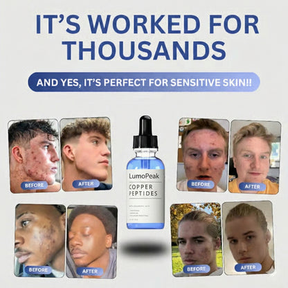 LumoPeak GHK-Cu Peptide  Serum